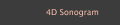 4D Sonogram